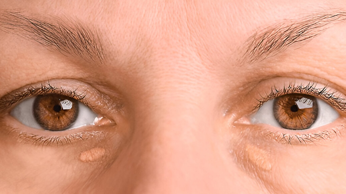 How does cholesterol affect