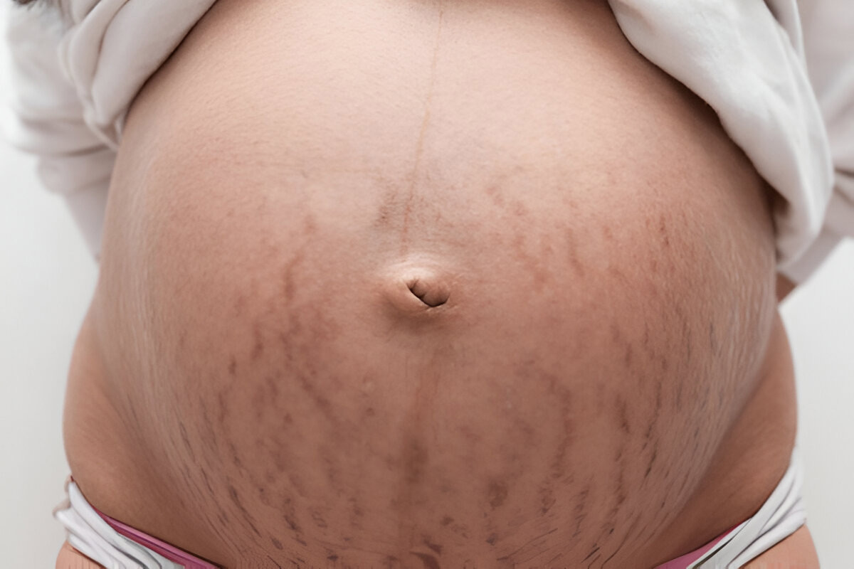 Why does your belly pop out when pregnant