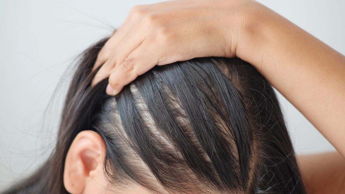 hair fall reducing spray