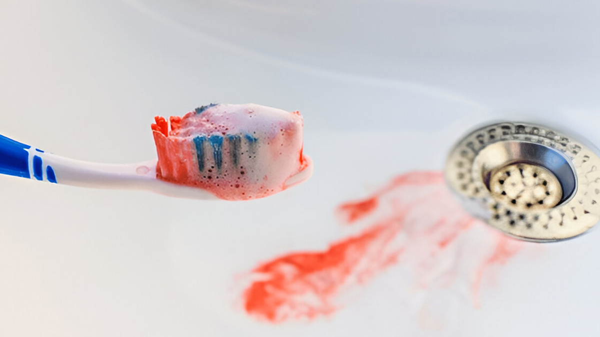 Bleeding gums reasons