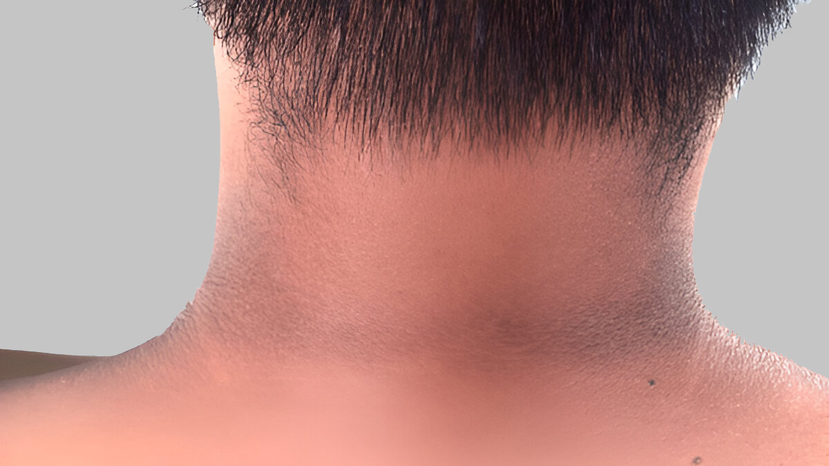 high insulin symptoms (2)