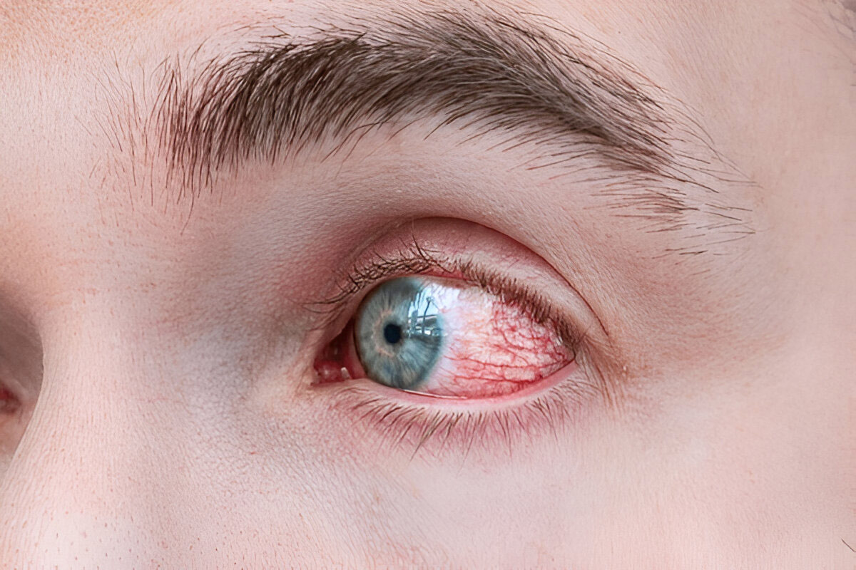 Eye care tips rainy season