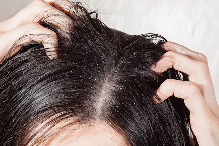 washing hair before oiling,scalp health