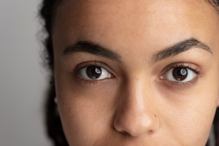 reason of dark circles