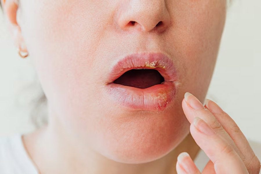 how to apply coconut oil on lips