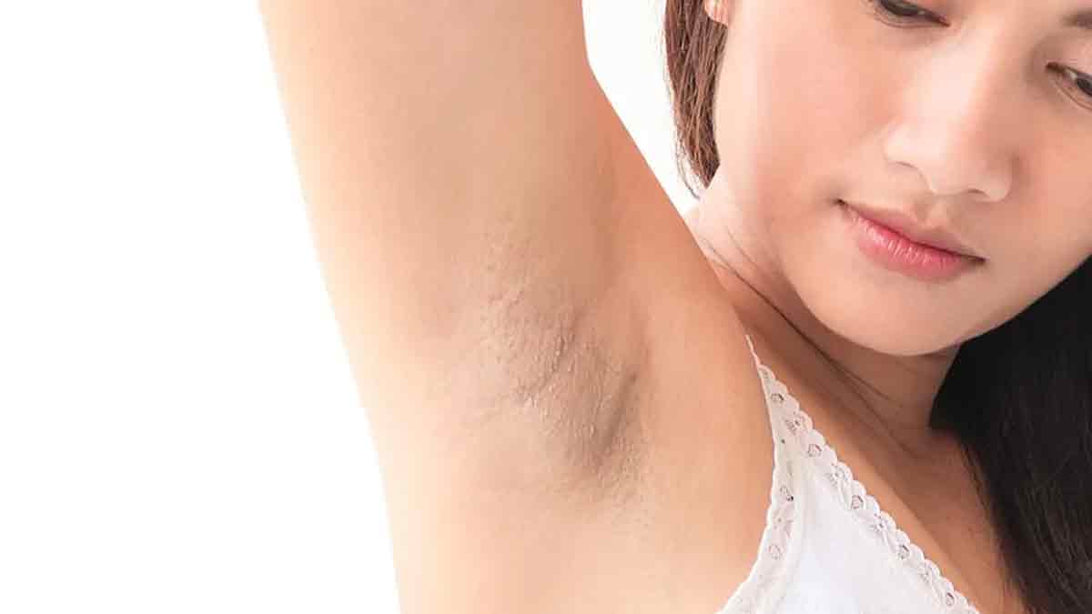 dark-armits-and-its-problems