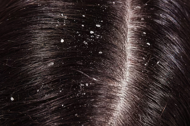 2 - 2025-08-01T141123.106