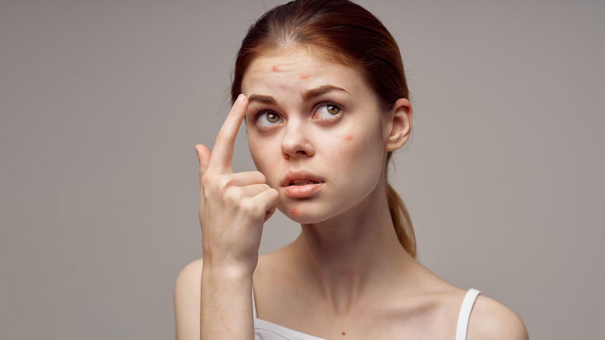 overnight treatment for acne scars