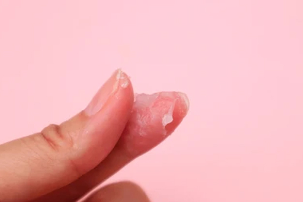 how to control vaginal dischrage in females