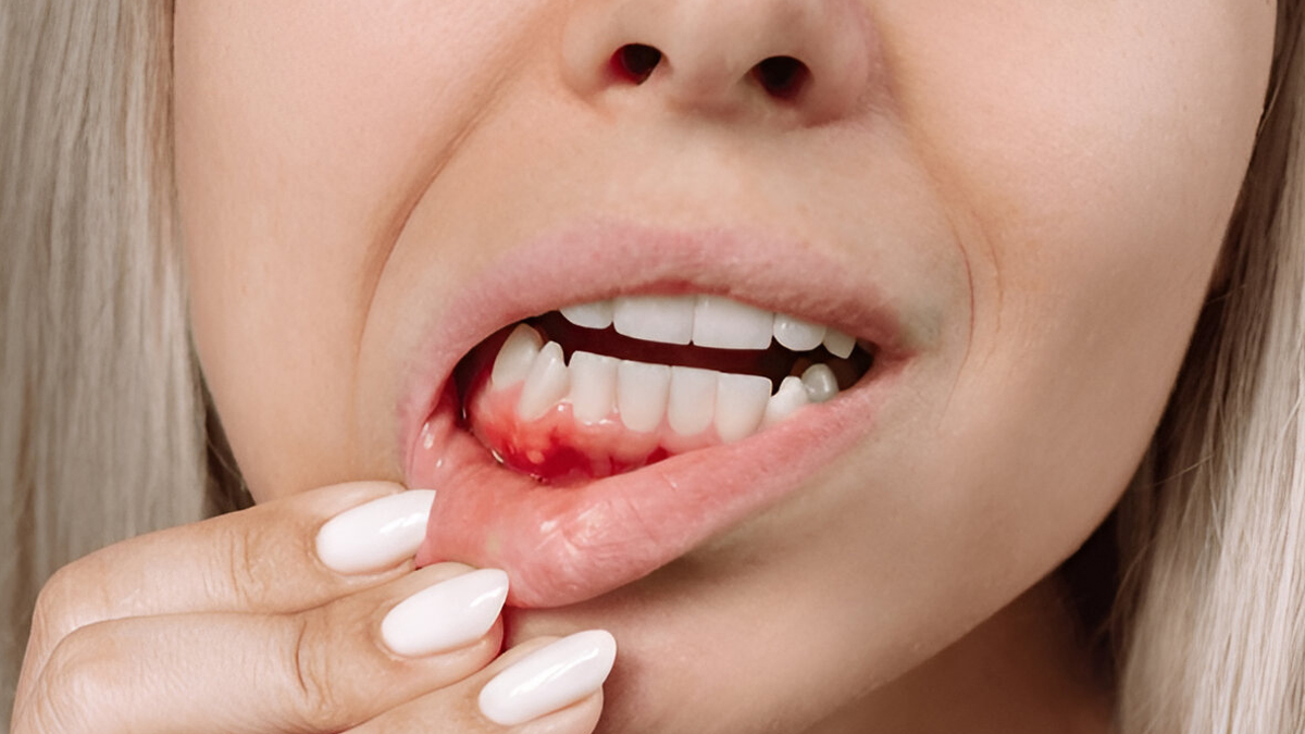 mouth symptoms that could be early warning signs of heart disease