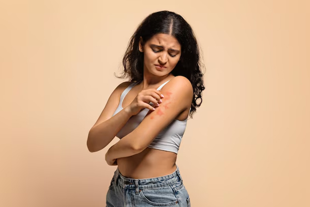 skin rashes signs of liver problem