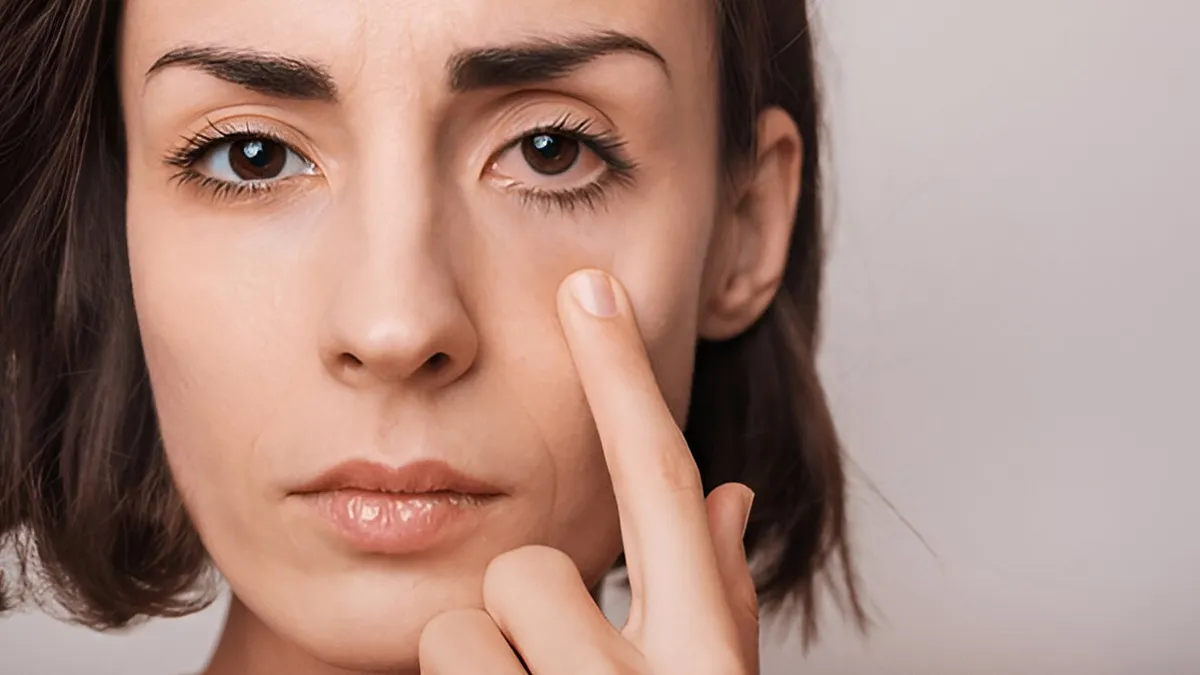 natural remedies for dry eyes