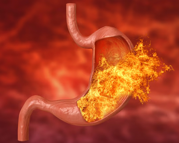 castor oil in navel for constipation and bloating