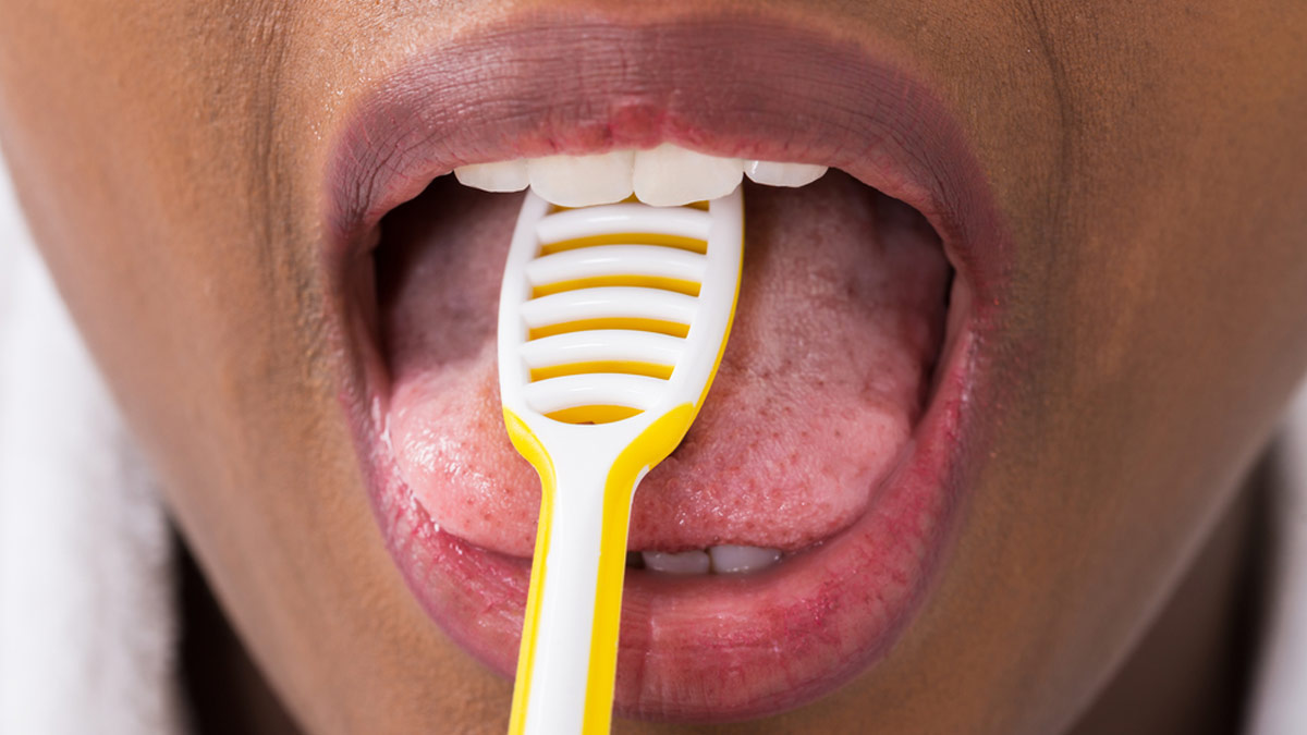 why tongue cleaning is important