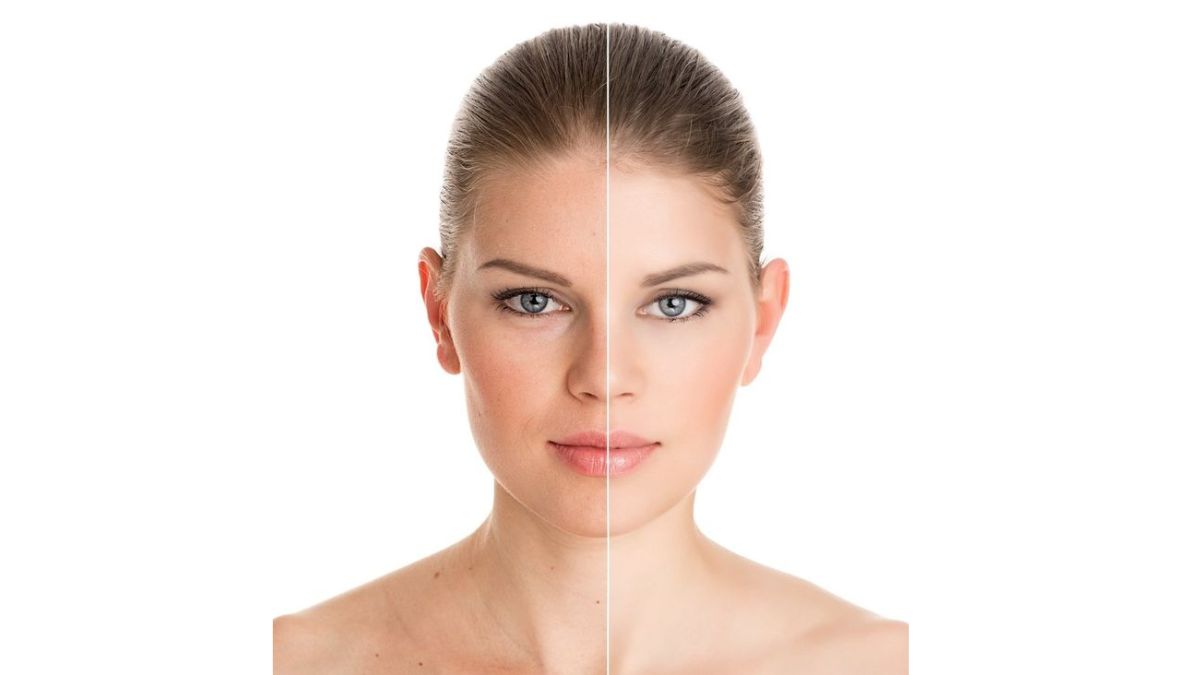 how to fix uneven skin tone fast
