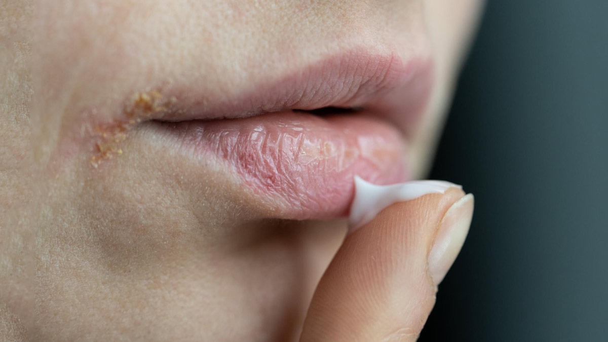 how to repair dry lips while sleeping