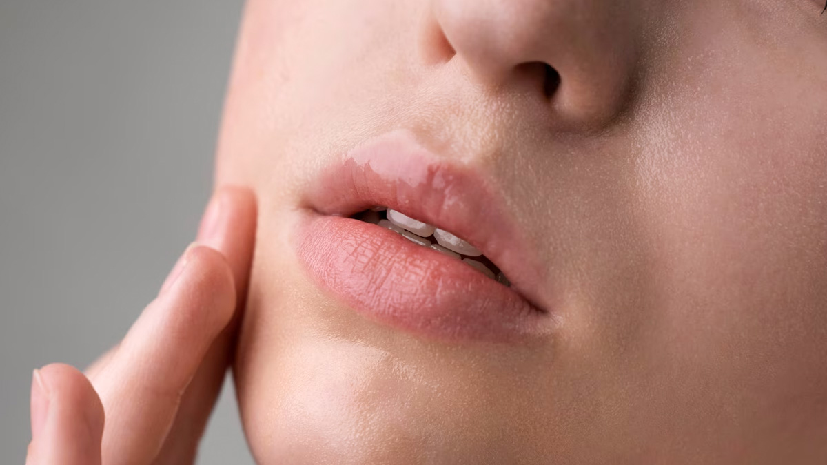 lip pigmentation prevention