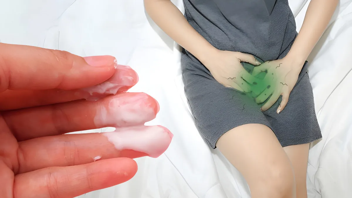 how vaginal white discharge can affect fertility