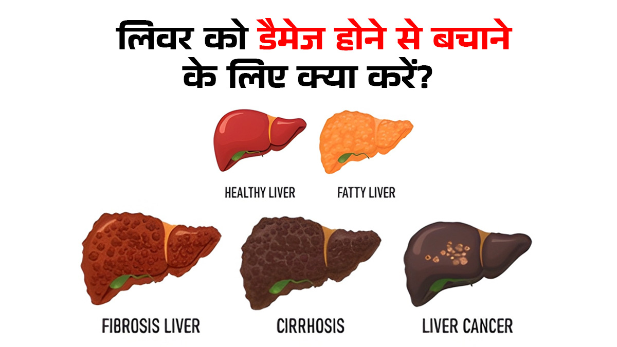 Grade 1 Fatty Liver को गंभीर बनने से रोकना है तो एक्सपर्ट की इन 3 बातों को न करें नजरअंदाज