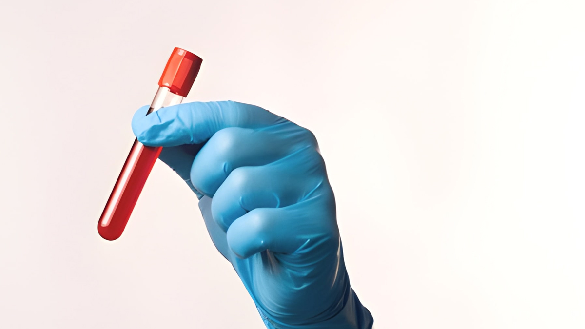 blood test for recurrent miscarriages