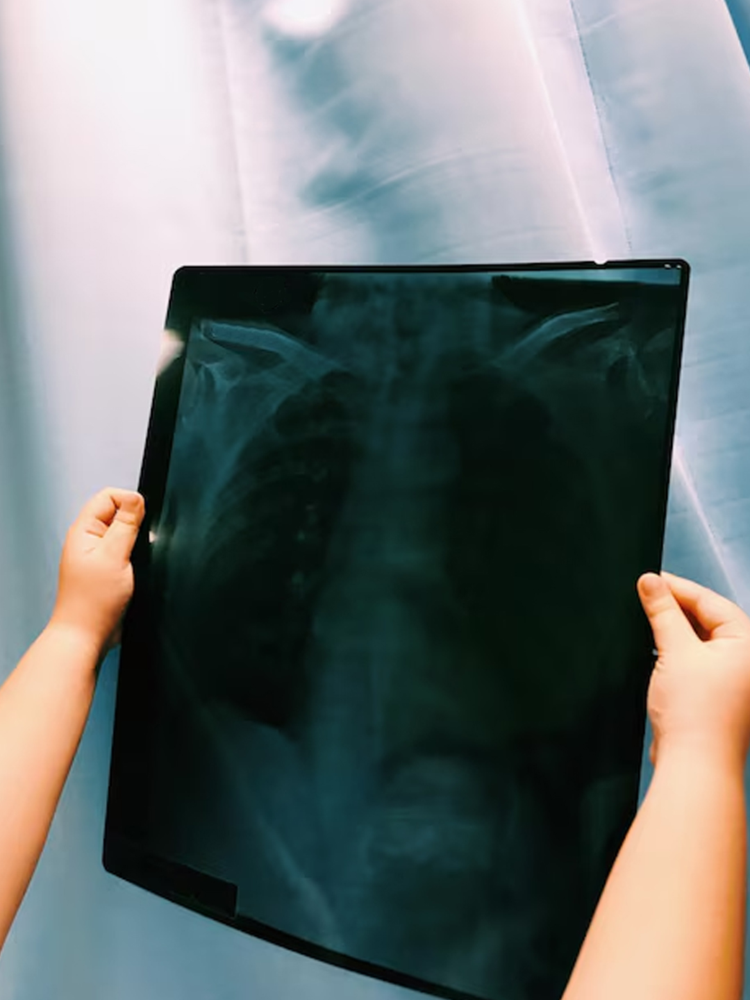 x-ray report reuse hacks