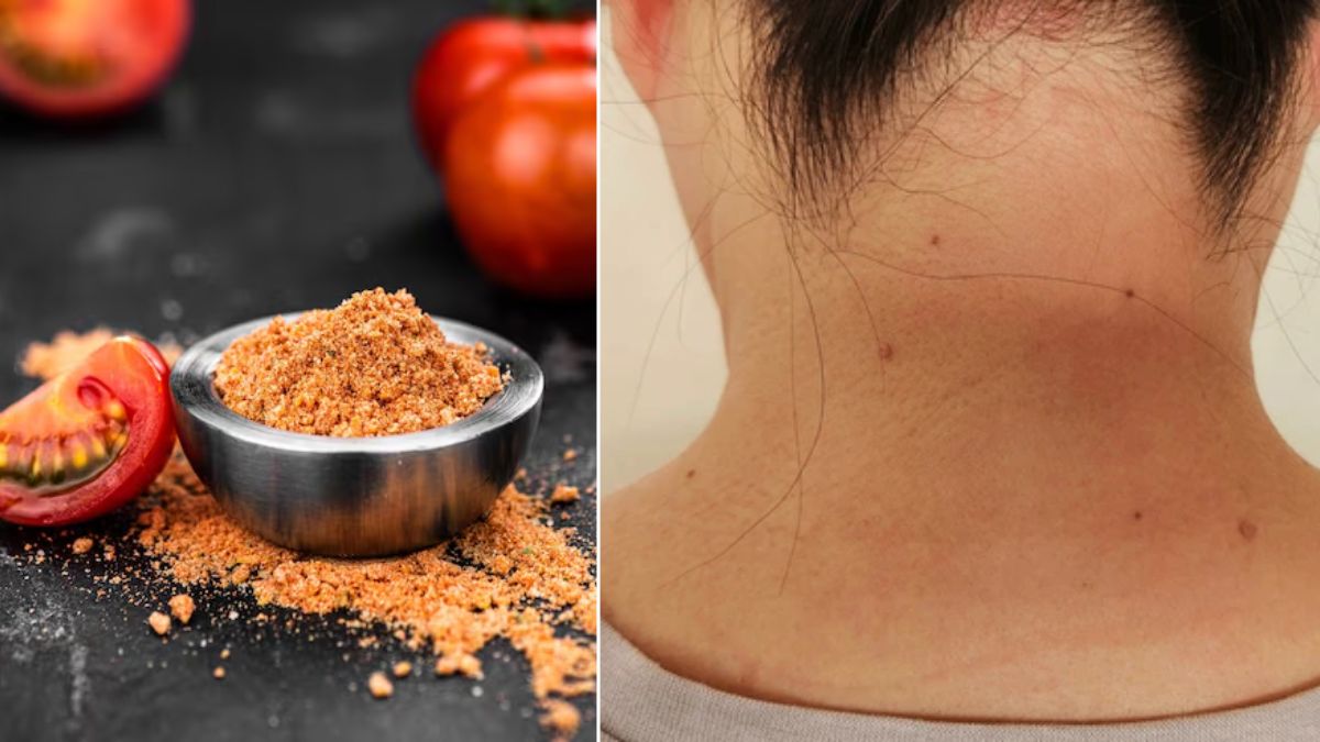 टमाटर और कॉफी से दूर होगा गर्दन का कालापन, ऐसे करें इस्तेमाल; साफ हो जाएगी स्किन