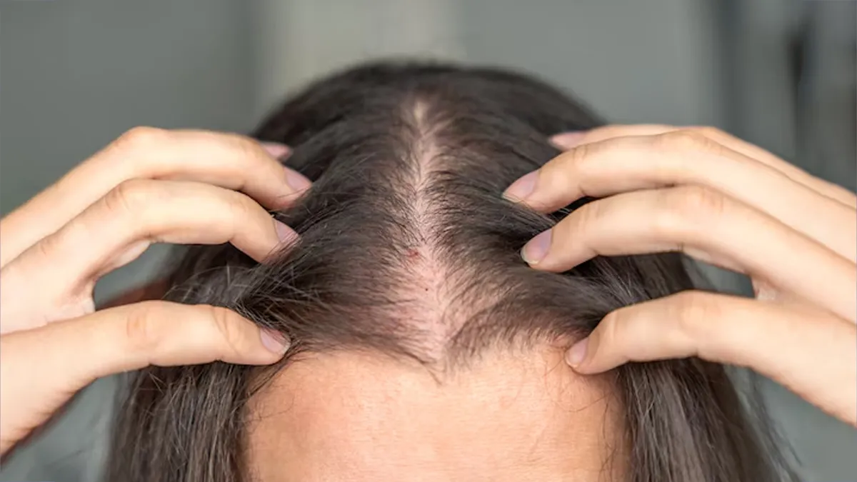 DIY hair oil recipe for hair fall