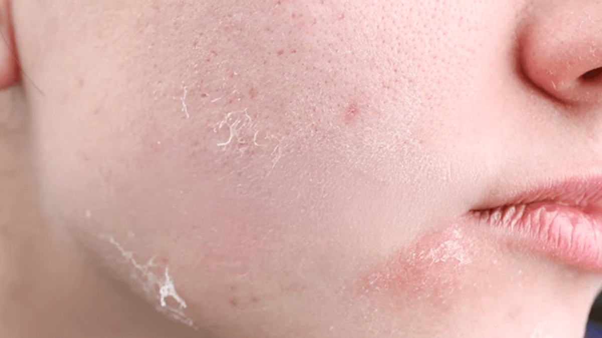 Dry Skin Care: ठंड में भी स्किन नहीं होगी रूखी और बेजान, दही में इन 2 चीजों को मिलाकर बनाएं फेस मास्क