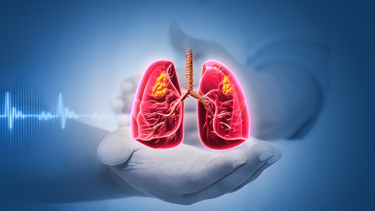 What is a superfood for lungs