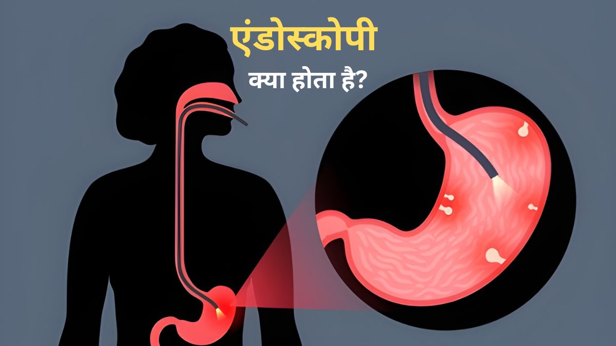 क्‍या आप जानती हैं एंडोस्कोपी में असल में आपके साथ क्या किया जाता है?