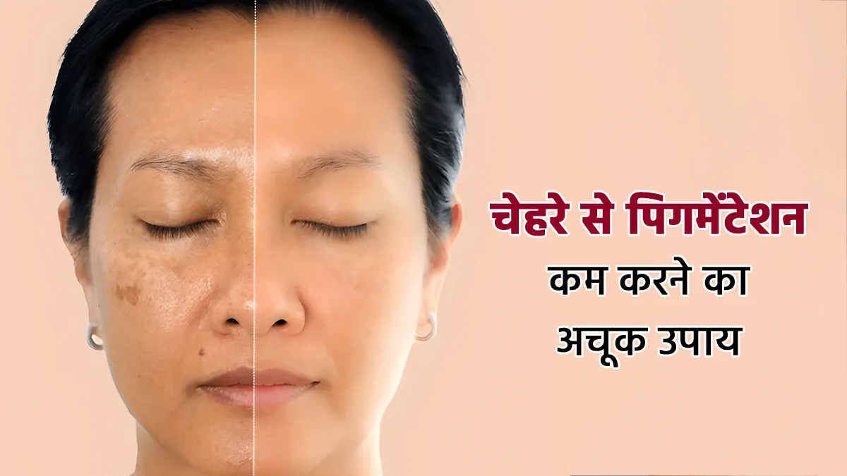  how to reduce pigmentation on face 