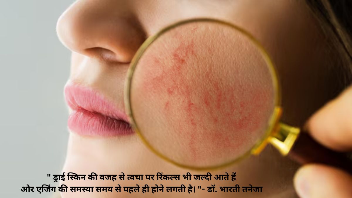 homemade night cream