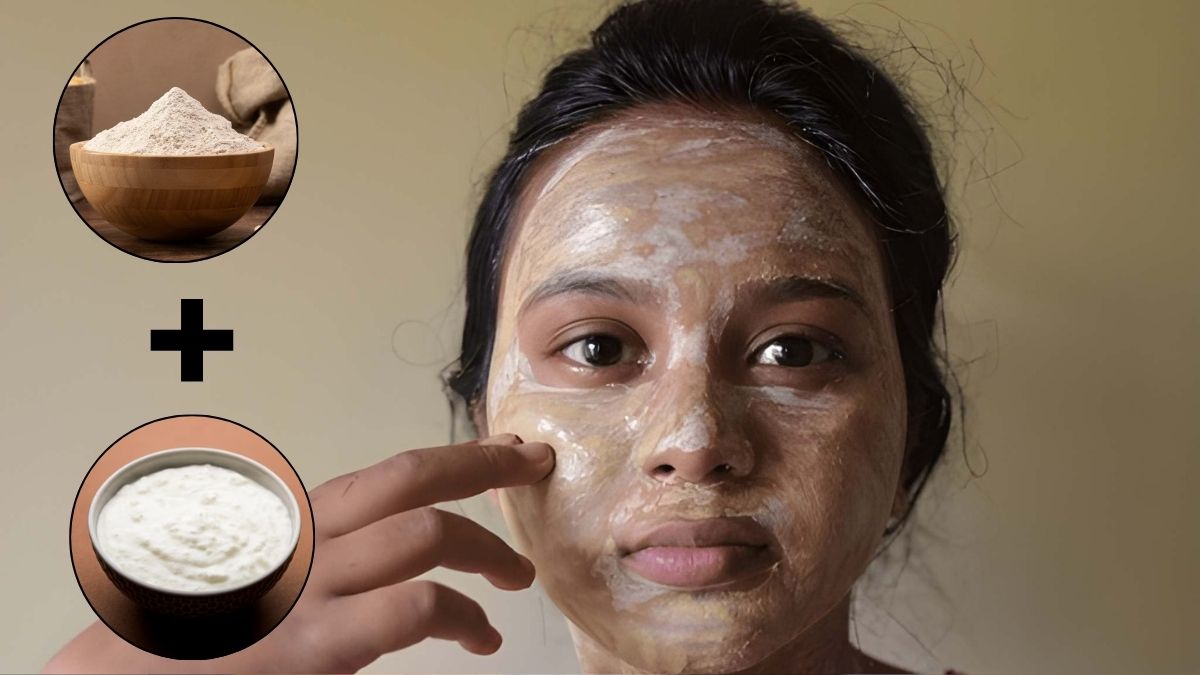 winter tanning removal tips