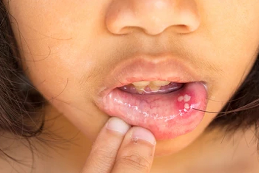 how to keep kissing safe for dental health