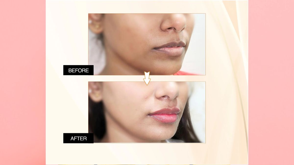 winter lip care tips