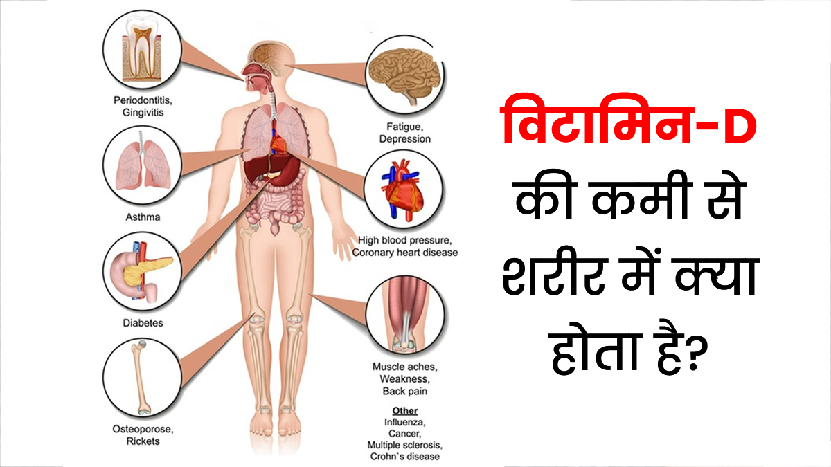 विटामिन D की कमी शरीर में मचा सकती है तबाही, सुबह धूप में ये काम करने से तेजी से बढ़ेगा लेवल