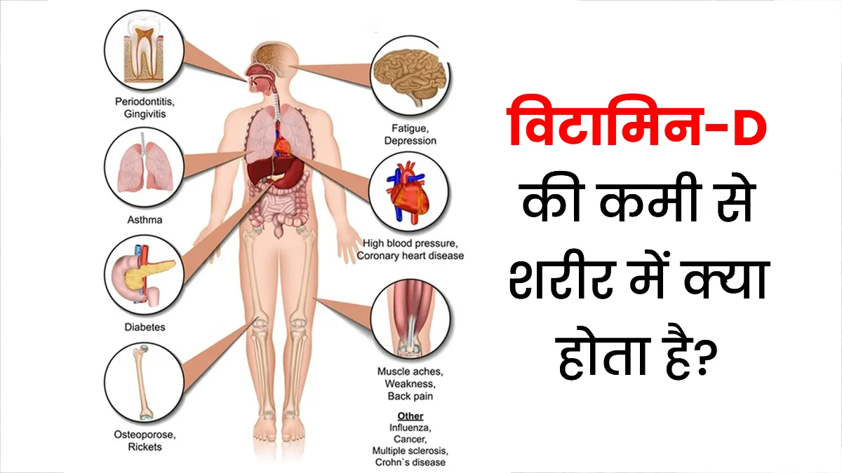 yoga for Vitamin D deficiency