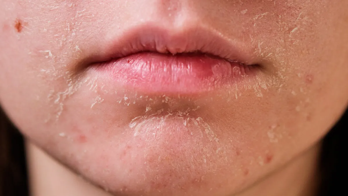 dry skin ke liye kaun sa tel lagaen