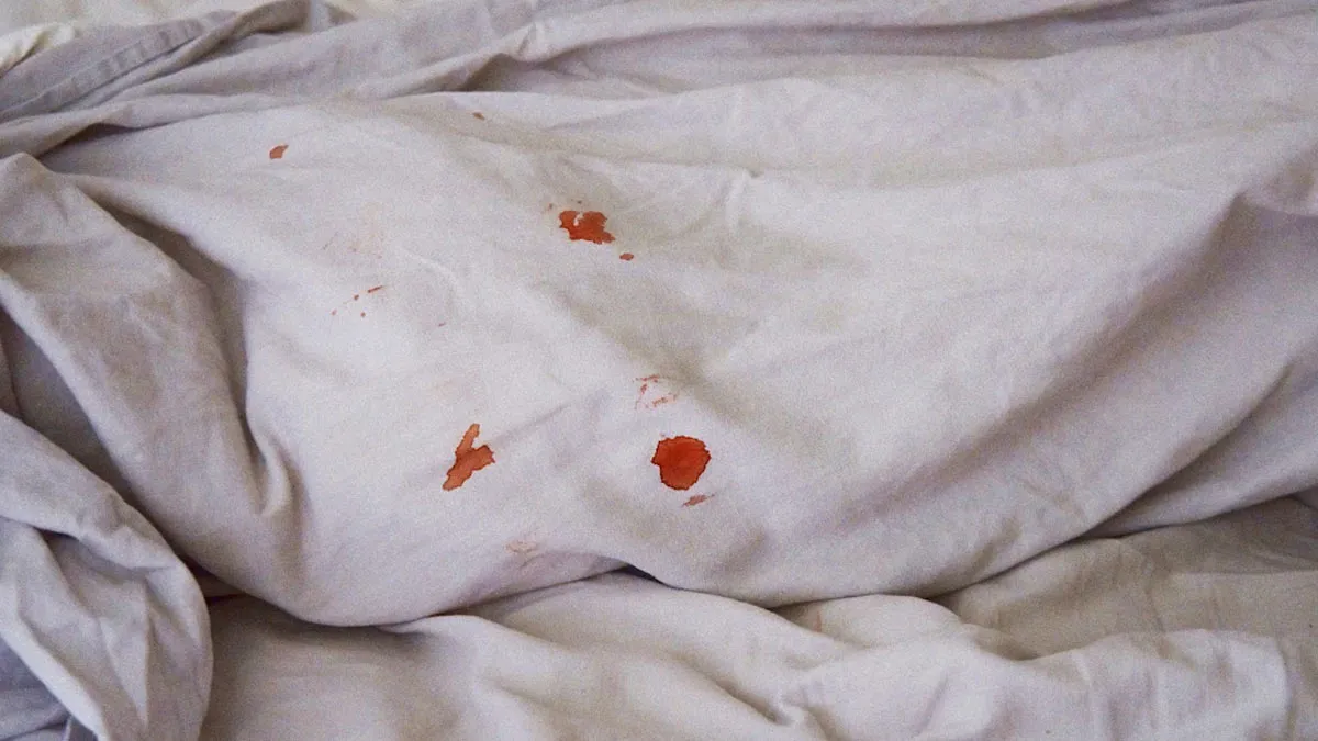 How to remove old stains from bed sheets