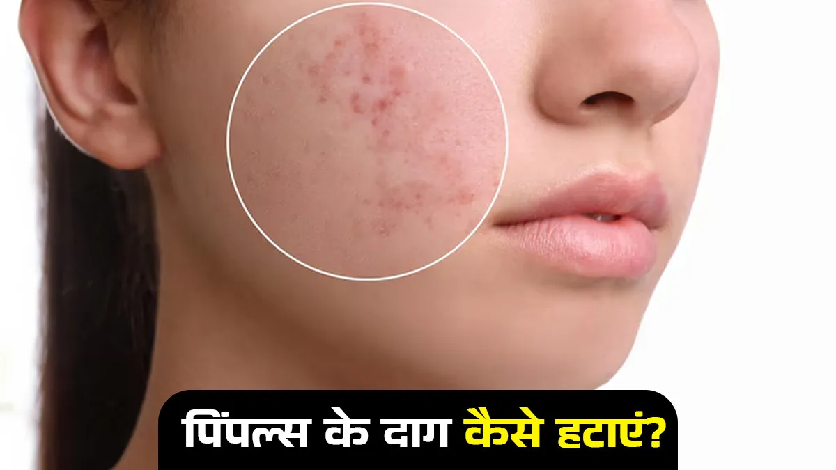 Homemade face masks for clear skin