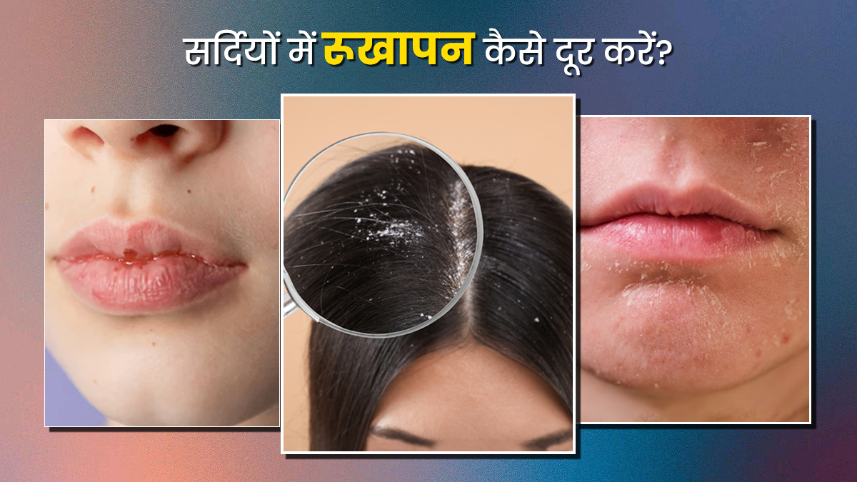 Winter Care: सिर्फ ये 1 सीक्रेट उपाय अपनाएं, चेहरा, बाल और होंठ होंगे मक्खन जैसे मुलायम
