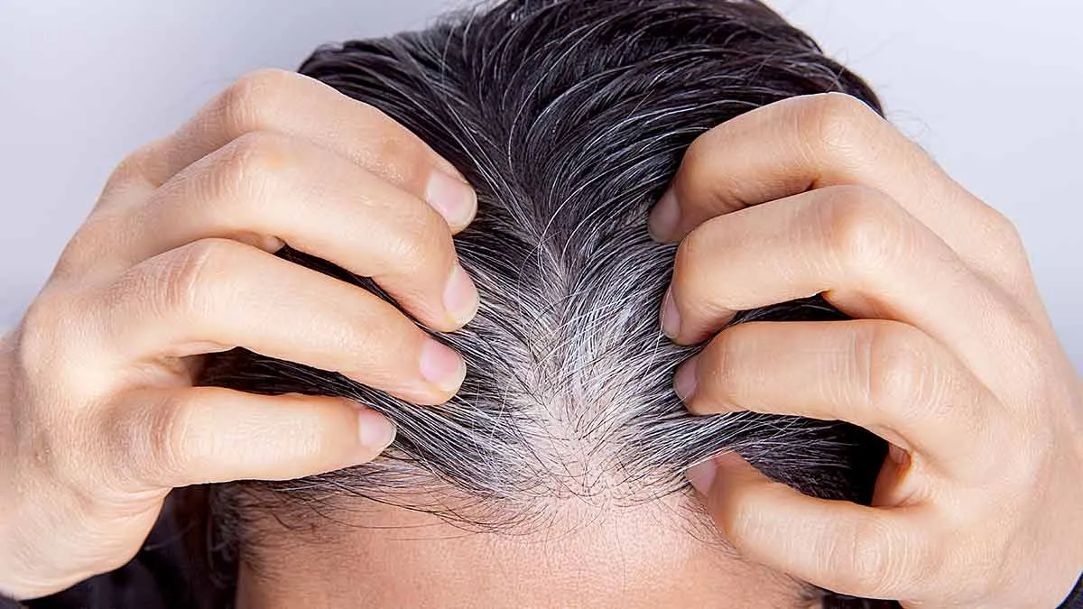 onion peel shampoo for white hair