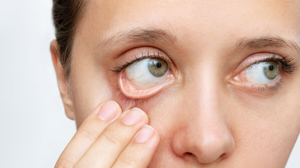eye symptoms in menopause