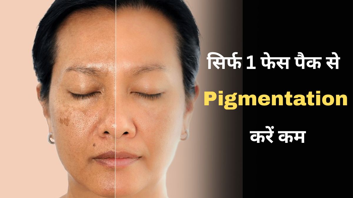 Pigmentation On Face: चेहरे पर पिगमेंटेशन से हैं परेशान?  इस Face Pack से हल्‍के पड़ जाएंगे निशान