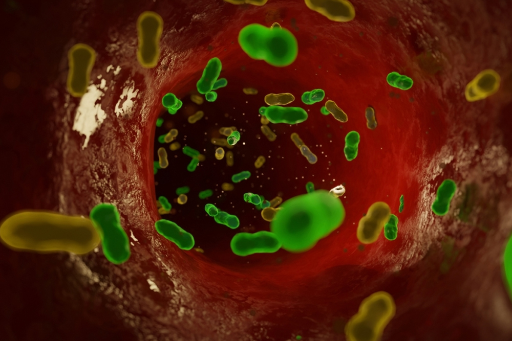 blood infection cause hiv