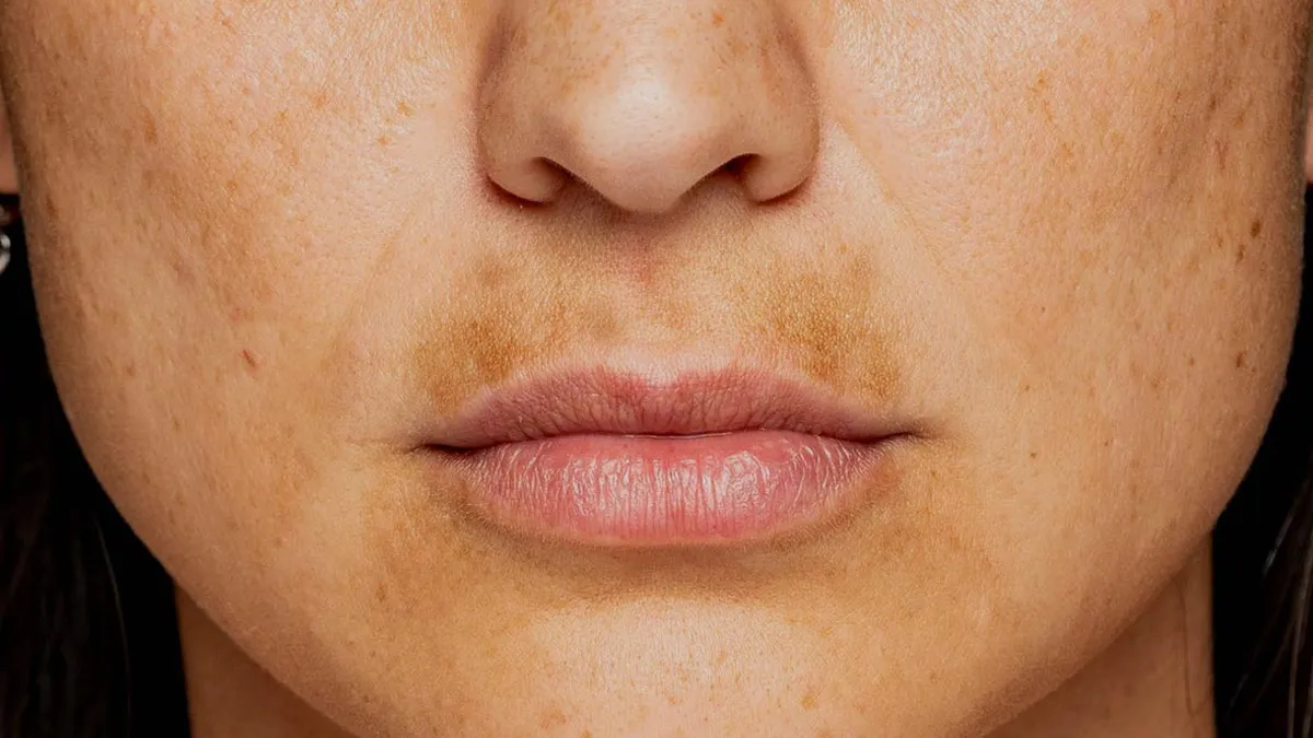 homemade serum for darkness around lips