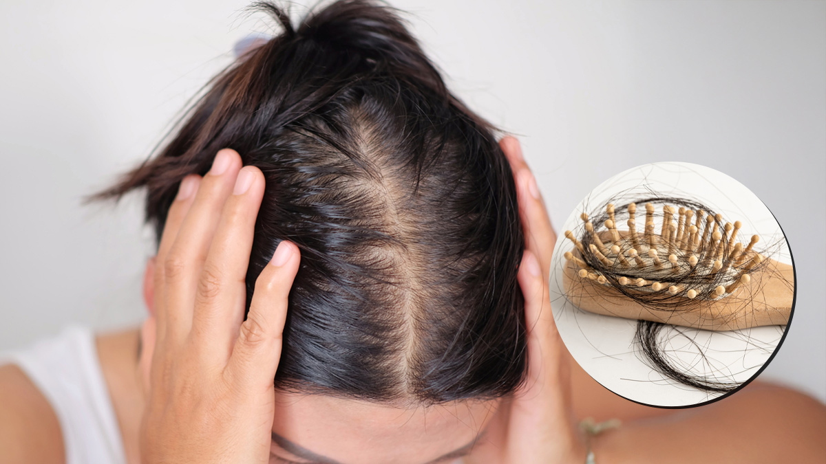 Winter Hair Care: क्‍या सर्दियों में बाल ज्‍यादा झड़ रहे हैं? ये 3 चीजें आज ही ठीक करें
