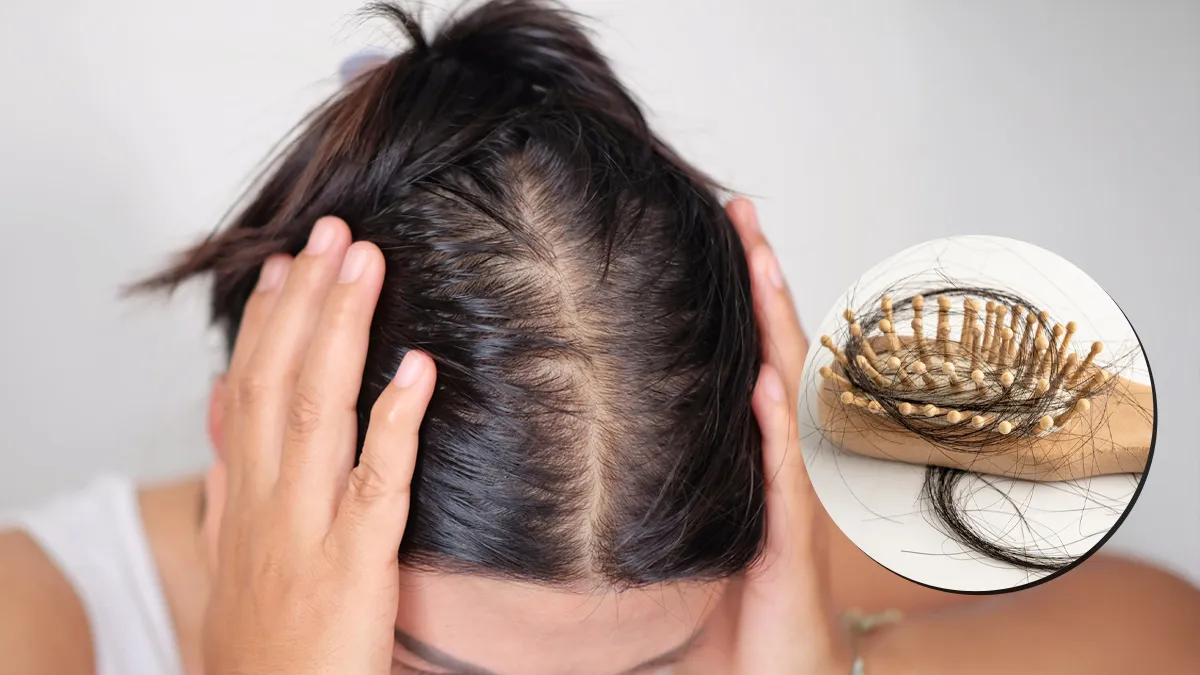 Stop Hair Fall Immediately