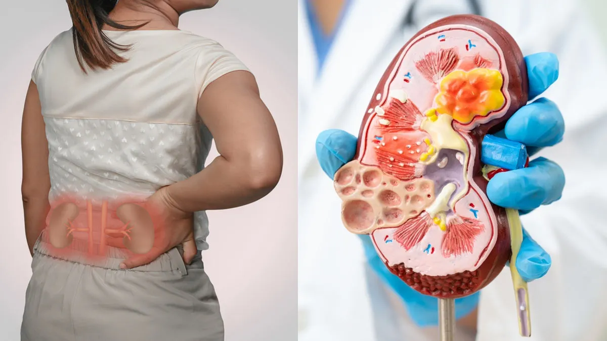 habits that lead to kidney problems