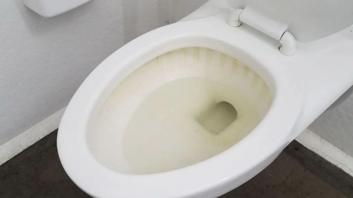 how to clean toilet seat yellow stains with lemon baking soda with detergent powderSD